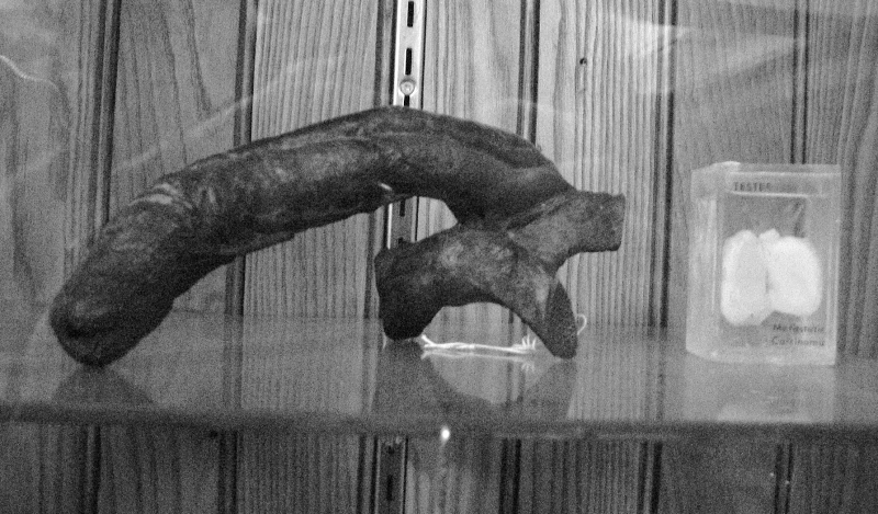 Illustration for article titled Museum of WTF: Mutant Pickled Babies and the World's Largest Colon